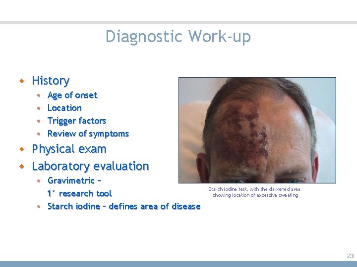 Diagnostic Work-up w History • • Age of onset Location Trigger factors Review of