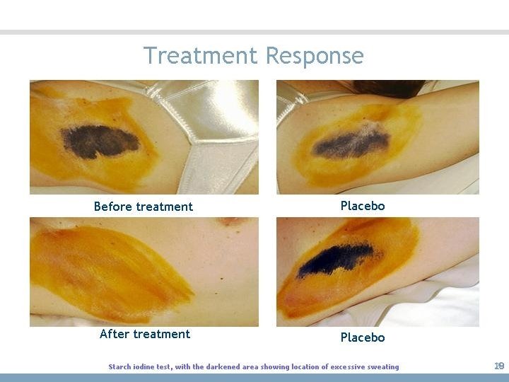 Treatment Response 29 