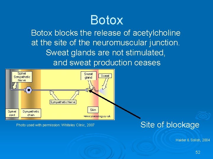 Botox blocks the release of acetylcholine at the site of the neuromuscular junction. Sweat