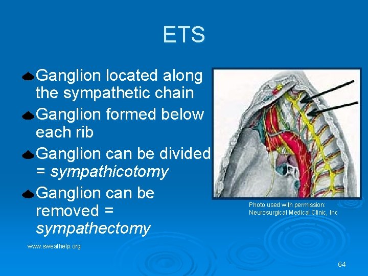 ETS Ganglion located along the sympathetic chain Ganglion formed below each rib Ganglion can