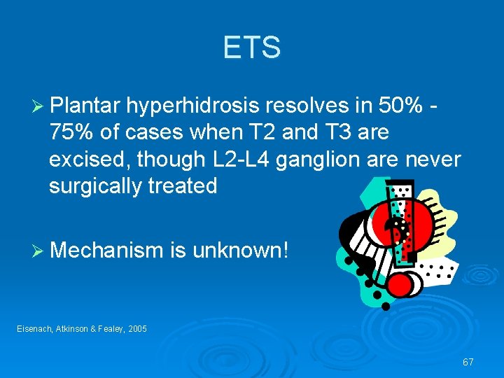 ETS Ø Plantar hyperhidrosis resolves in 50% - 75% of cases when T 2