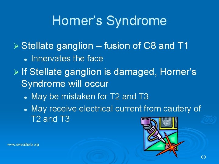 Horner’s Syndrome Ø Stellate ganglion – fusion of C 8 and T 1 l