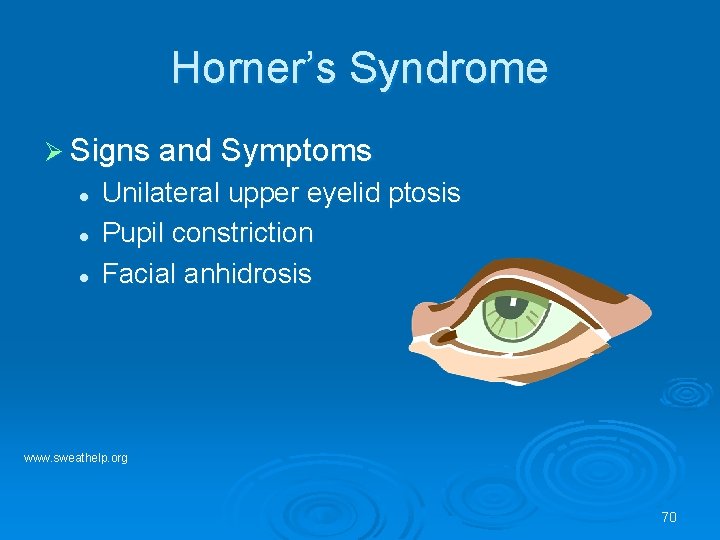 Horner’s Syndrome Ø Signs and Symptoms l l l Unilateral upper eyelid ptosis Pupil