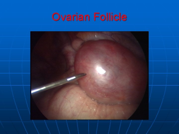 Ovarian Follicle 