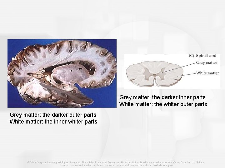 Grey matter: the darker inner parts White matter: the whiter outer parts Grey matter: