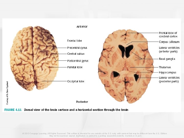 © 2013 Cengage Learning. All Rights Reserved. This edition is intended for use outside