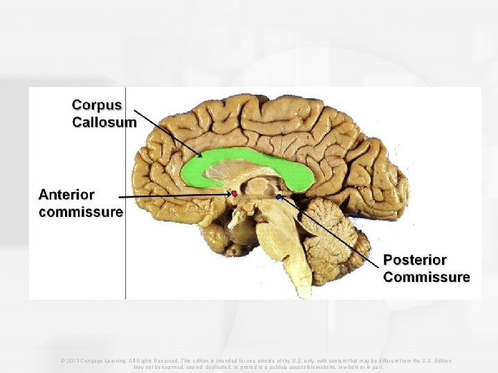 © 2013 Cengage Learning. All Rights Reserved. This edition is intended for use outside