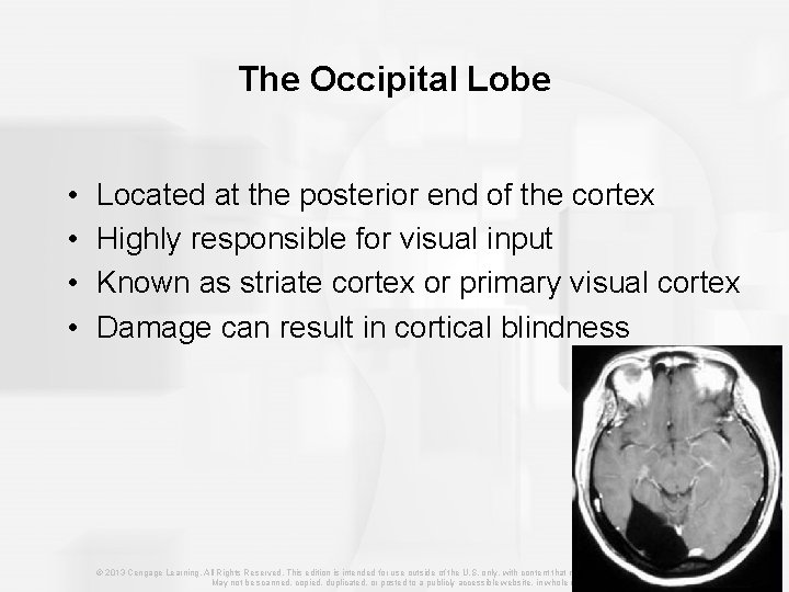The Occipital Lobe • • Located at the posterior end of the cortex Highly