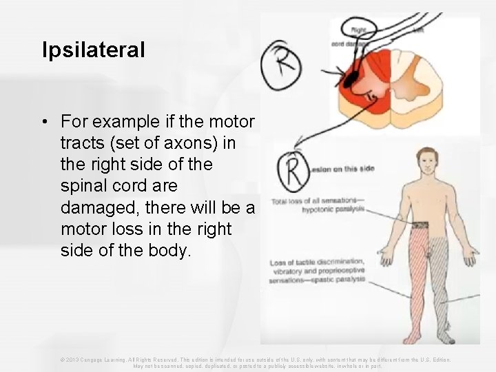 Ipsilateral • For example if the motor tracts (set of axons) in the right