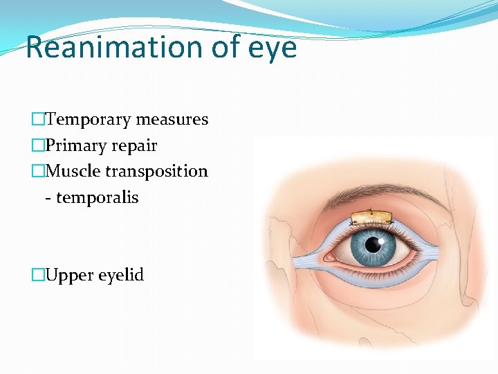 Reanimation of eye �Temporary measures �Primary repair �Muscle transposition - temporalis �Upper eyelid 