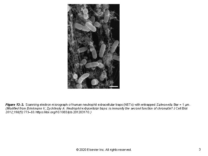Figure 12– 2. Scanning electron micrograph of human neutrophil extracellular traps (NETs) with entrapped