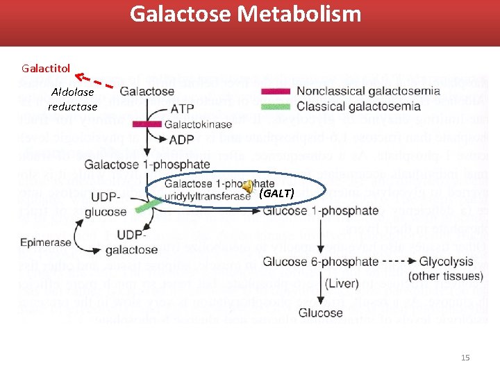 Galactose Metabolism Galactose metabolism: Galactitol Aldolase reductase (GALT) 15 