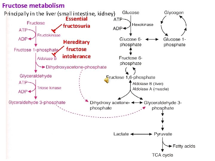 Fructose metabolism Principally in the liver (small intestine, kidney) Essential fructosuria Hereditary fructose intolerance