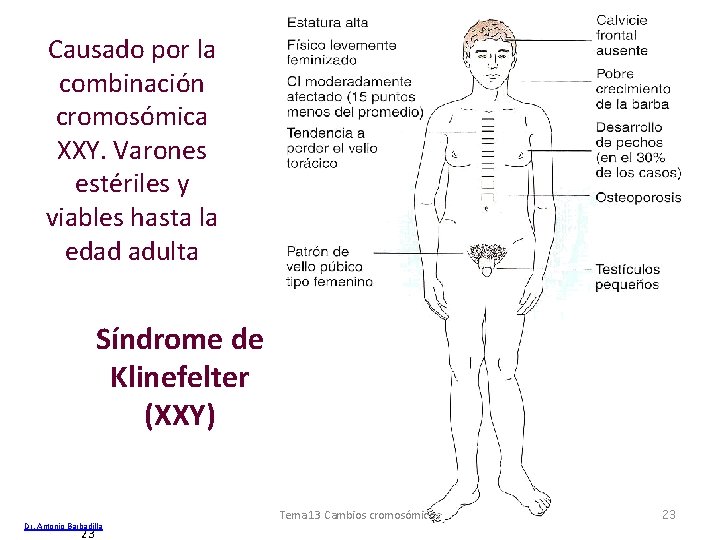 Causado por la combinación cromosómica XXY. Varones estériles y viables hasta la edad adulta
