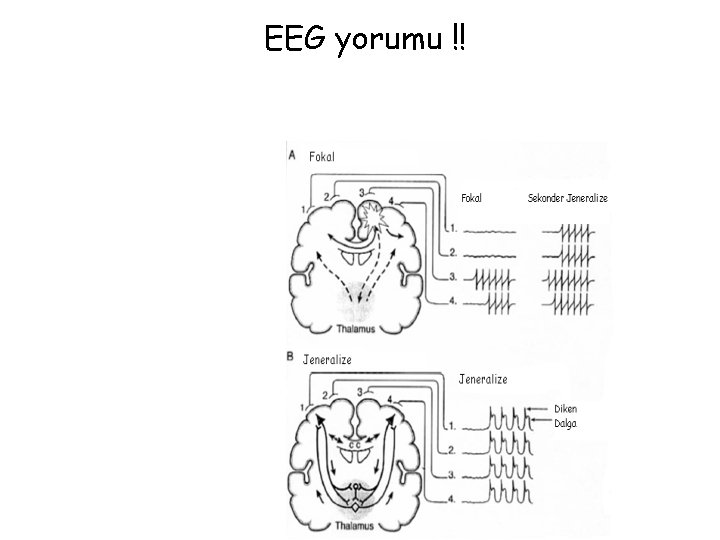 EEG yorumu !! 