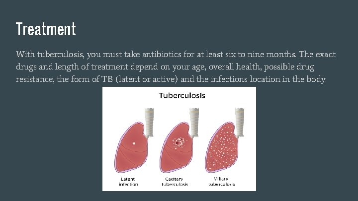 Treatment With tuberculosis, you must take antibiotics for at least six to nine months.