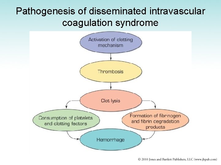 Pathogenesis of disseminated intravascular coagulation syndrome 