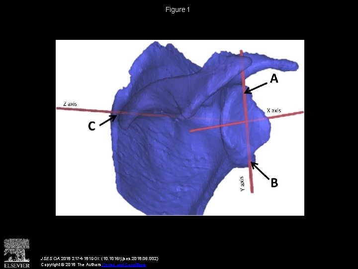 Figure 1 JSES OA 2018 2174 -181 DOI: (10. 1016/j. jses. 2018. 06. 002)