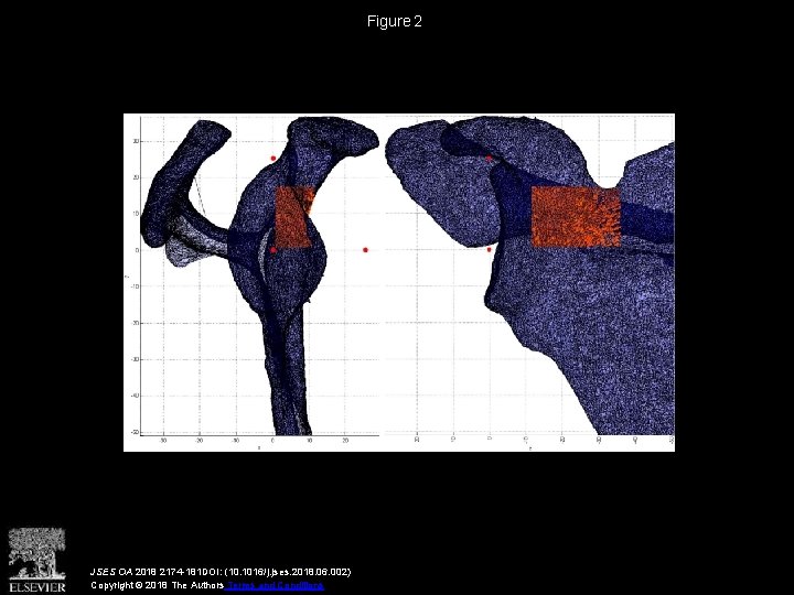 Figure 2 JSES OA 2018 2174 -181 DOI: (10. 1016/j. jses. 2018. 06. 002)