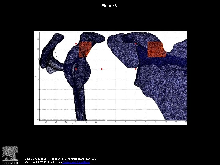 Figure 3 JSES OA 2018 2174 -181 DOI: (10. 1016/j. jses. 2018. 06. 002)