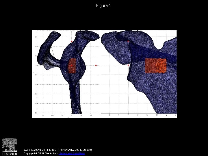 Figure 4 JSES OA 2018 2174 -181 DOI: (10. 1016/j. jses. 2018. 06. 002)