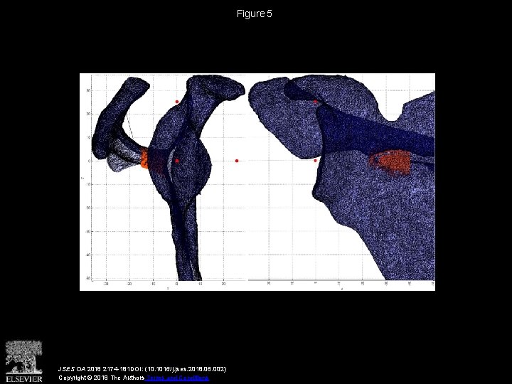Figure 5 JSES OA 2018 2174 -181 DOI: (10. 1016/j. jses. 2018. 06. 002)