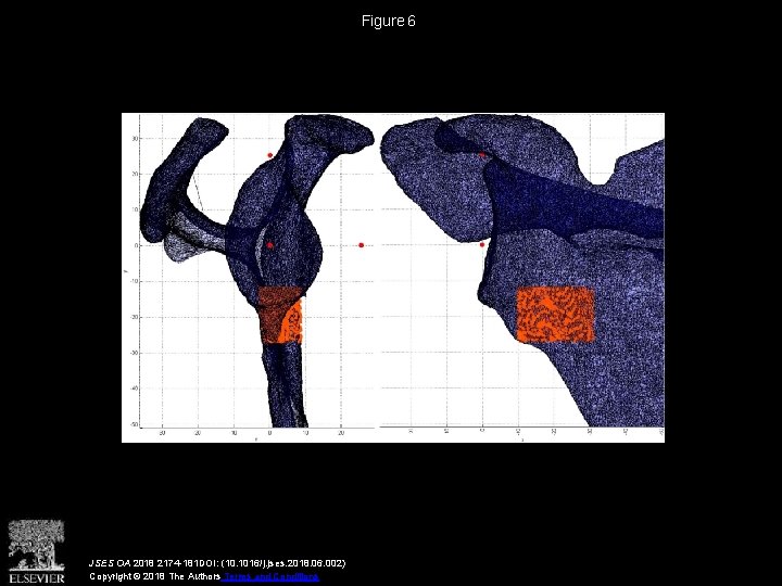 Figure 6 JSES OA 2018 2174 -181 DOI: (10. 1016/j. jses. 2018. 06. 002)