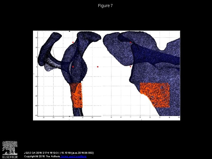 Figure 7 JSES OA 2018 2174 -181 DOI: (10. 1016/j. jses. 2018. 06. 002)