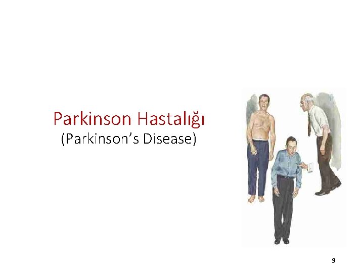 Parkinson Hastalığı (Parkinson’s Disease) 9 