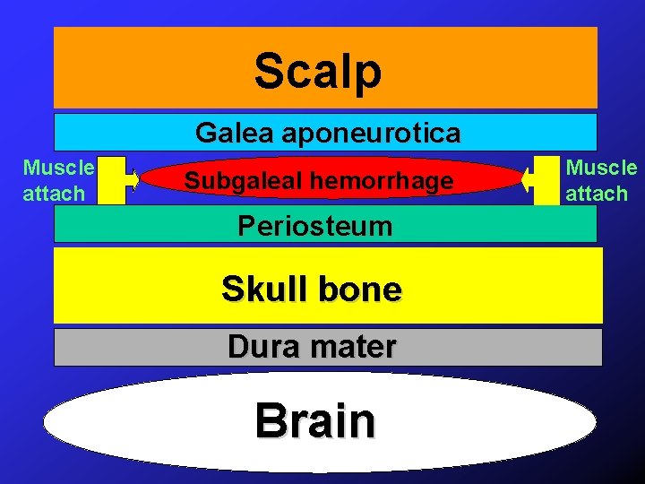 Scalp Galea aponeurotica Muscle attach Subgaleal hemorrhage Periosteum Skull bone Dura mater Brain Muscle