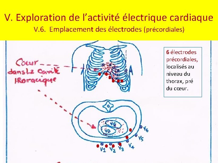 V. Exploration de l’activité électrique cardiaque V. 6. Emplacement des électrodes (précordiales) 6 électrodes