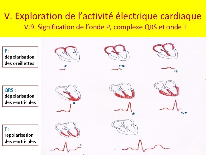 V. Exploration de l’activité électrique cardiaque V. 9. Signification de l’onde P, complexe QRS