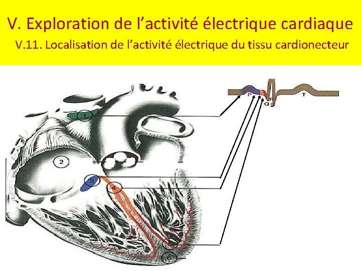 V. Exploration de l’activité électrique cardiaque V. 11. Localisation de l’activité électrique du tissu