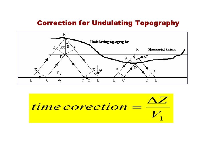 Correction for Undulating Topography 