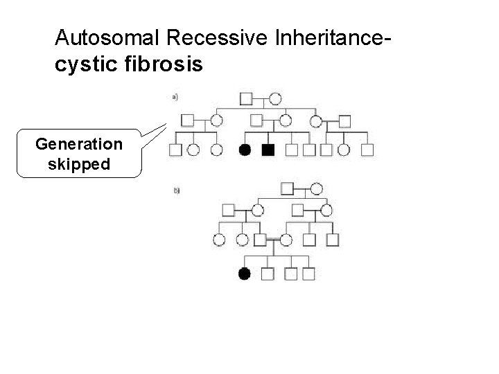 Autosomal Recessive Inheritancecystic fibrosis Generation skipped 