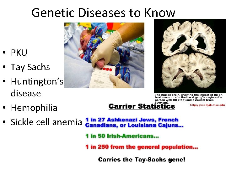 Genetic Diseases to Know • PKU • Tay Sachs • Huntington’s disease • Hemophilia
