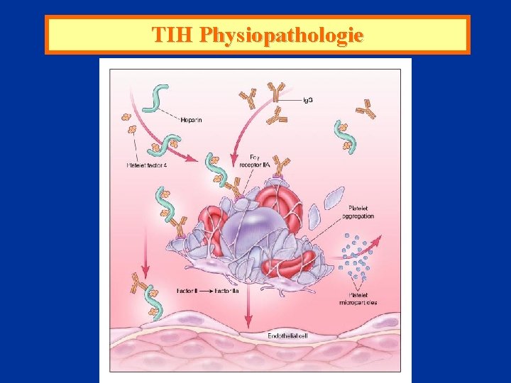 TIH Physiopathologie 