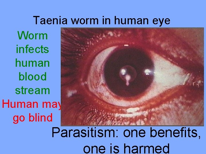 Taenia worm in human eye Worm infects human blood stream Human may go blind