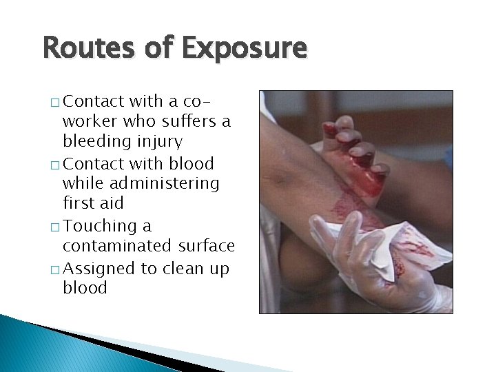 Routes of Exposure � Contact with a coworker who suffers a bleeding injury �