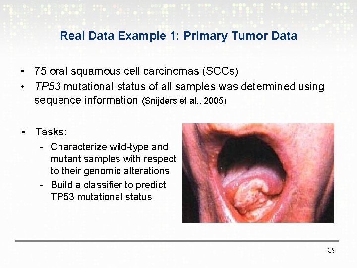 Real Data Example 1: Primary Tumor Data • 75 oral squamous cell carcinomas (SCCs)