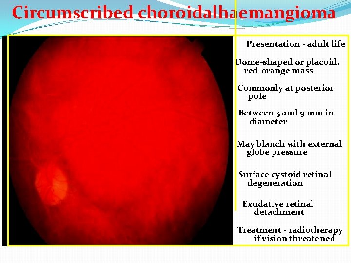 Circumscribed choroidalhaemangioma Presentation - adult life Dome-shaped or placoid, red-orange mass Commonly at posterior