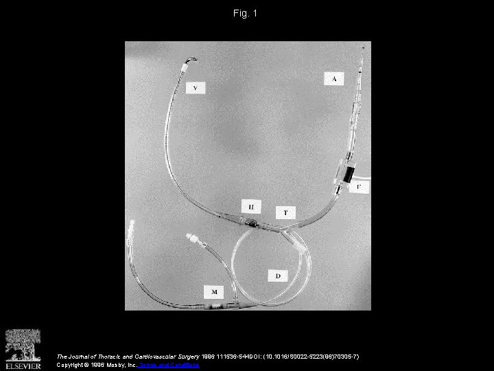 Fig. 1 The Journal of Thoracic and Cardiovascular Surgery 1996 111536 -544 DOI: (10.