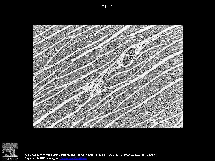 Fig. 3 The Journal of Thoracic and Cardiovascular Surgery 1996 111536 -544 DOI: (10.