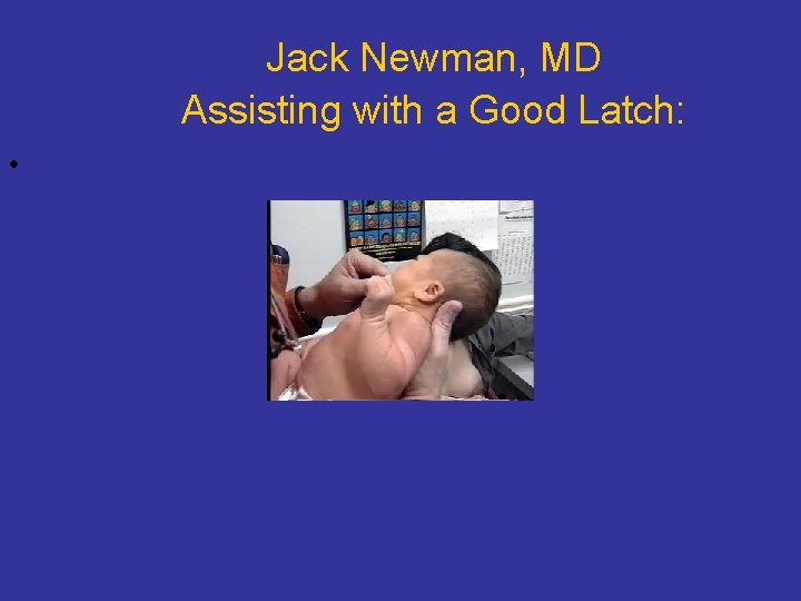 Jack Newman, MD Assisting with a Good Latch: • 