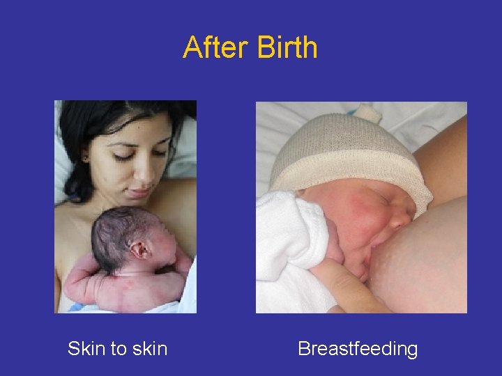 After Birth Skin to skin Breastfeeding 