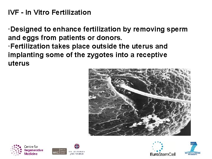 IVF - In Vitro Fertilization ·Designed to enhance fertilization by removing sperm and eggs