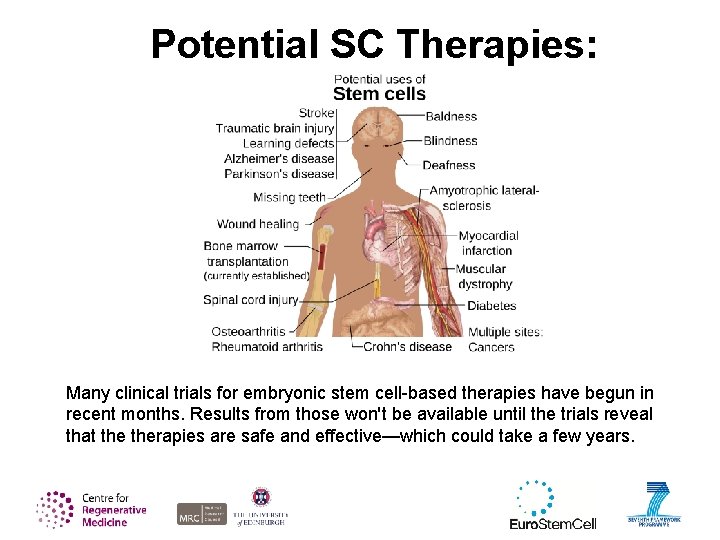Potential SC Therapies: Many clinical trials for embryonic stem cell-based therapies have begun in