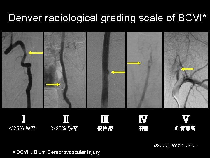 Denver radiological grading scale of BCVI* Ⅰ ＜ 25% 狭窄 Ⅱ ＞ 25% 狭窄