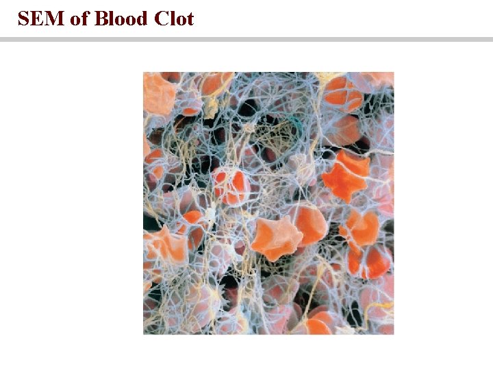 SEM of Blood Clot 