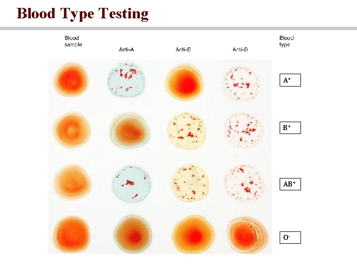Blood Type Testing A+ B+ AB+ O- 